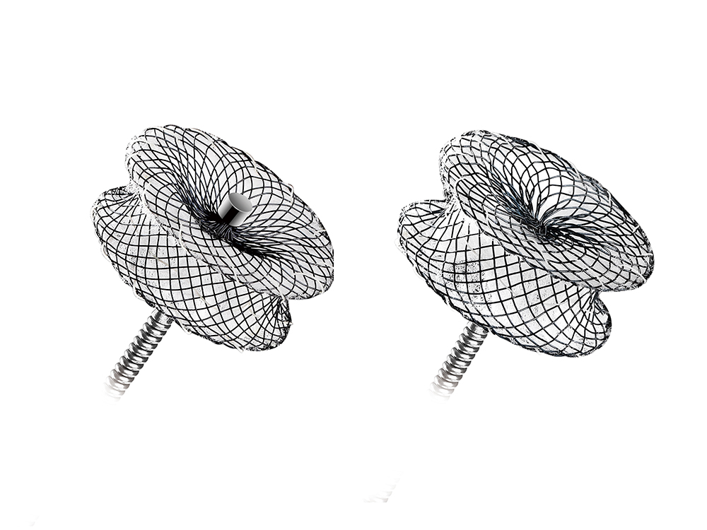 MemoPart™  Ventricular Septal Defect (VSD) Occluder