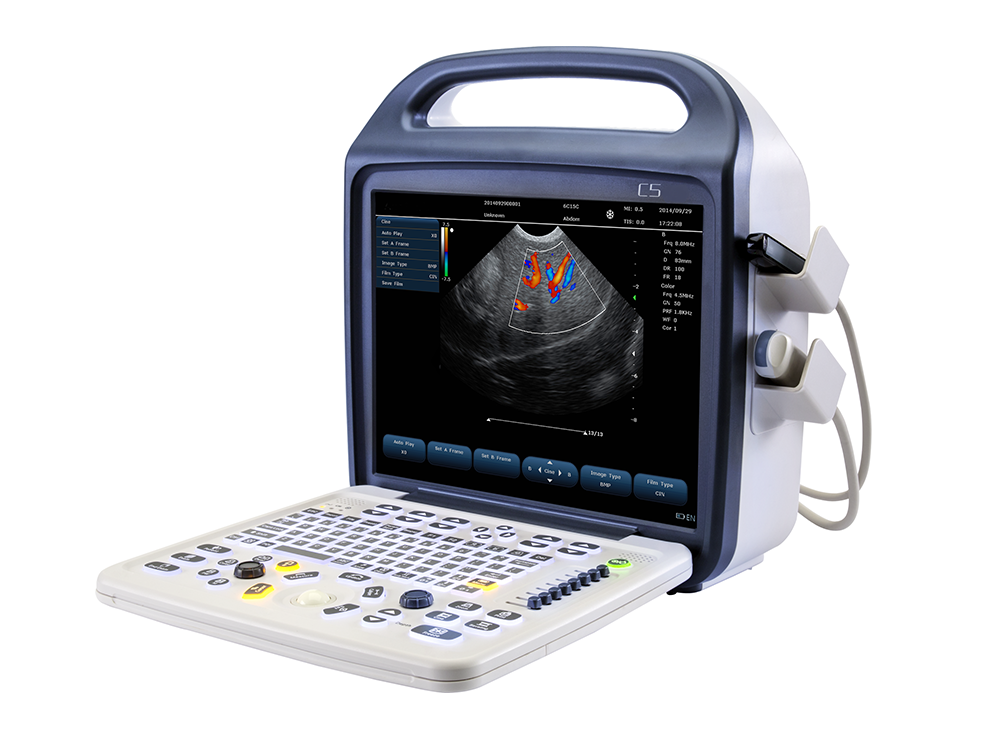C5Plus Portable Ultrasound