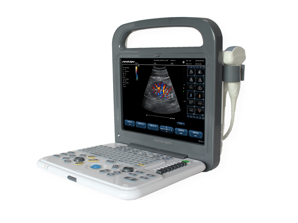 Ultrasound