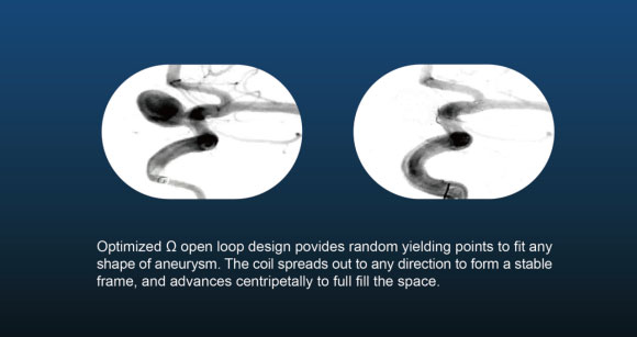 Neuro Coil